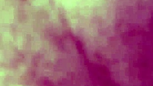 Amputee grandpas most viewed video perfect for masturbating to 😜