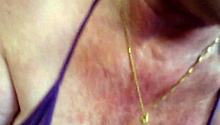 dawnskye1962 presents first asian derogatory name calling