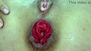 Destroyed Anal Juicy Prolapse Asshole Close Up Play With Extreme Emotions