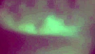 Segunda parte de la video llamada